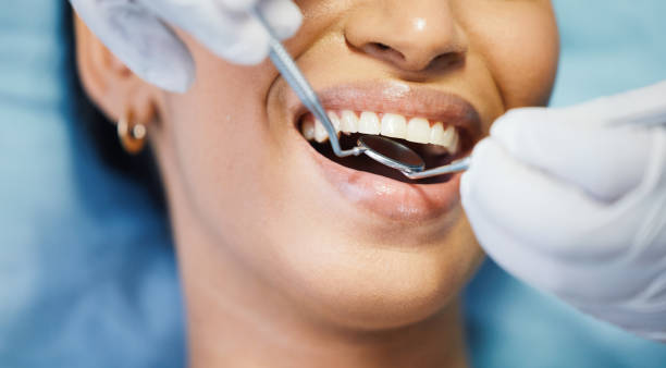 Best Root Canal Emergency Dentist  in Villas, NJ