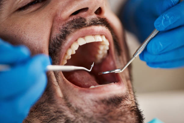 Best Tooth Infection Emergency Dentist  in Villas, NJ